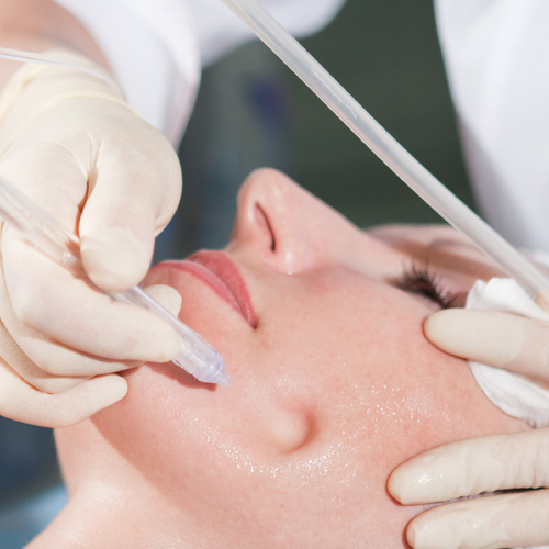 Jet Peel — Hydrafacial